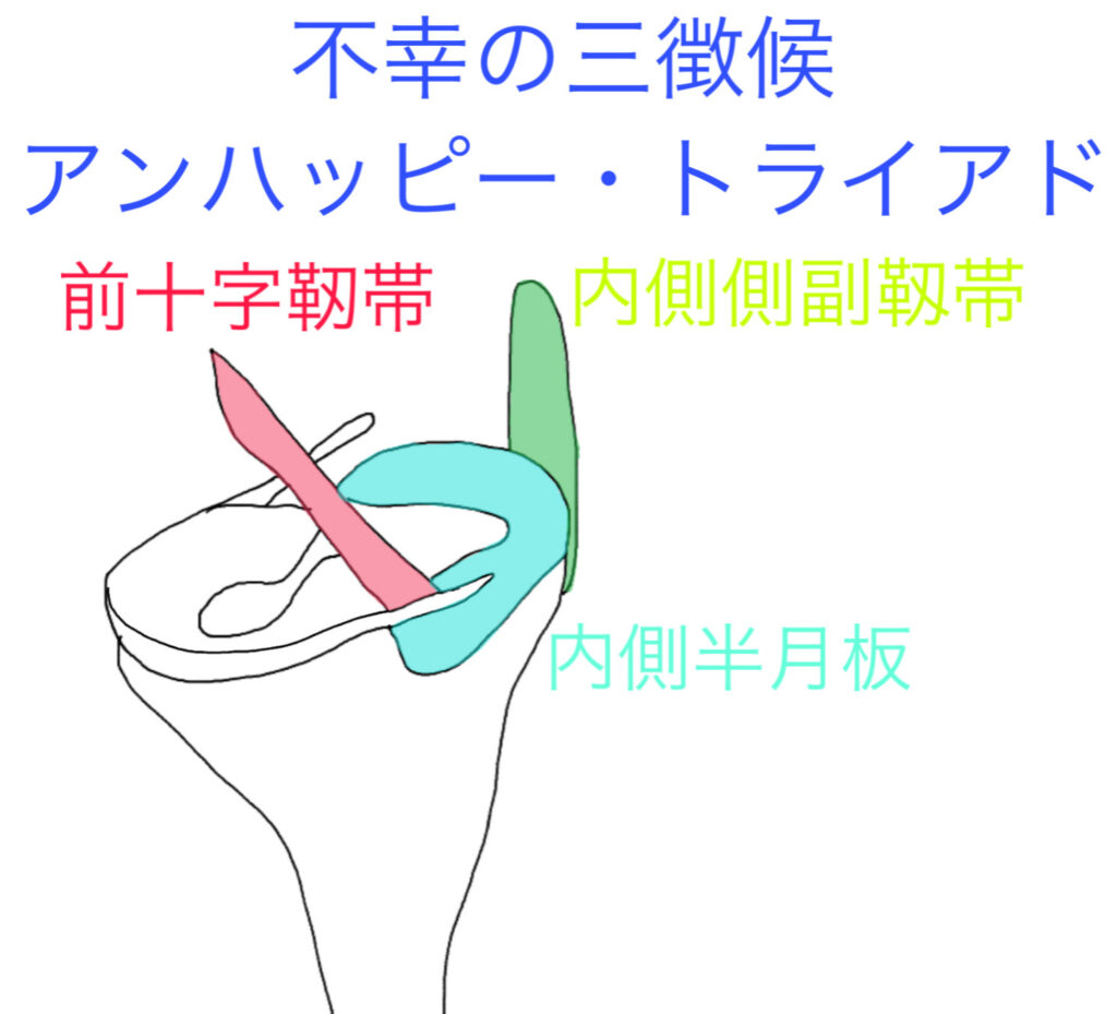 アンハッピートライアド