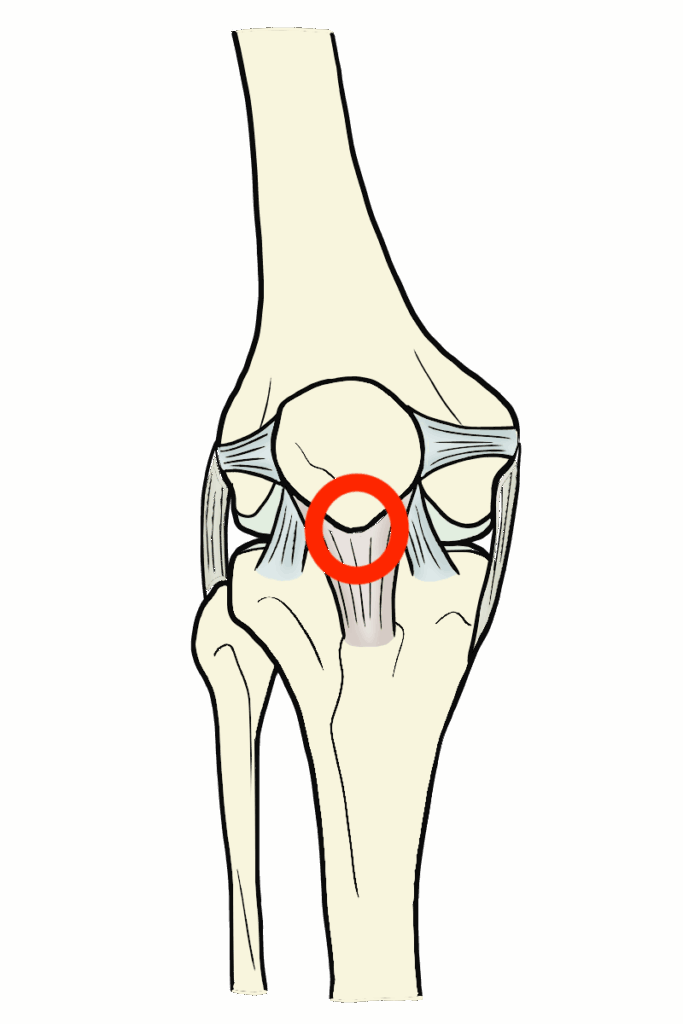 ジャンパー膝　痛み　ピンポイント